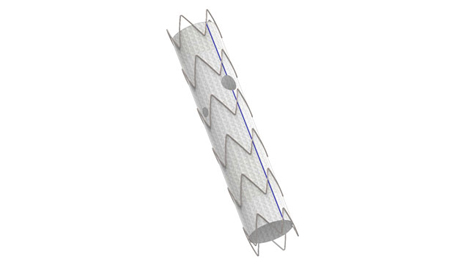 Schematische Darstellung